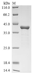 Greater than 85% as determined by SDS-PAGE.Recombinant Pseudomonas Aeruginosa Exotoxin A (ETA) Protein (His-KSI)
