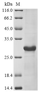 Greater than 85% as determined by SDS-PAGE.Recombinant Mumps Virus Hemagglutinin-Neuraminidase (HN) Protein (His)