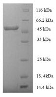 Greater than 90% as determined by SDS-PAGE.Recombinant Human Hla Class I Histocompatibility Antigen, Alpha Chain E (HLA-E) Protein (His-SUMO)