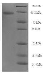 Greater than 90% as determined by SDS-PAGE.Recombinant Clostridium Botulinum Botulinum Neurotoxin Type A (BOTA) Protein (His-SUMO)