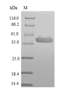 Greater than 90% as determined by SDS-PAGE.Recombinant Rotavirus A Outer Capsid Protein Vp4,E.Coli Protein (His-SUMO)