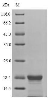 Greater than 90% as determined by SDS-PAGE.Recombinant Epstein-Barr Virus Latent Membrane Protein 2 (LMP2) Protein (His-SUMO)