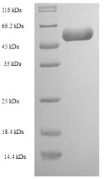 Greater than 90% as determined by SDS-PAGE.Recombinant Rabies Virus Nucleoprotein (N) Protein (His)
