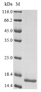 Greater than 85% as determined by SDS-PAGE.Recombinant Human Coronavirus 229E Spike Glycoprotein (S) Protein (His&Myc)