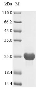 Greater than 85% as determined by SDS-PAGE.Recombinant Human Cytomegalovirus Uncharacterized Protein Ul128 (UL128) Protein (His)