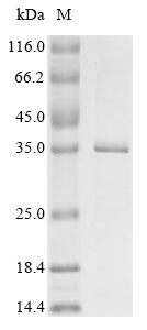 Greater than 85% as determined by SDS-PAGE.Recombinant Porcine Parvovirus Initiator Protein Ns1 (NS1) Protein (His&Myc)