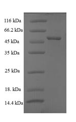 Greater than 90% as determined by SDS-PAGE.Recombinant Rotavirus A Intermediate Capsid Protein Vp6 Protein (His)