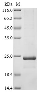 Greater than 85% as determined by SDS-PAGE.Recombinant Feline Coronavirus Non-Structural Protein 7A (7A) Protein (His-SUMO&Myc)