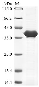 Greater than 85% as determined by SDS-PAGE.Recombinant Vaccinia Virus Protein B5 (PS/HR) Protein (His&Myc)