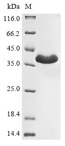 Greater than 85% as determined by SDS-PAGE.Recombinant Legionella Pneumophila Zinc Metalloproteinase Protein (His)