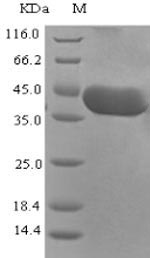 Greater than 90% as determined by SDS-PAGE.Recombinant Rift Valley Fever Virus Nucleoprotein (N) Protein (His-SUMO)