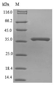 Greater than 85% as determined by SDS-PAGE.Recombinant Rabies Virus Matrix Protein (M) Protein (His-B2M)