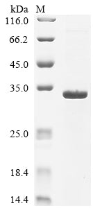 Greater than 90% as determined by SDS-PAGE.Recombinant Rabies Virus Matrix Protein (M) Protein (His)