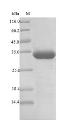 Greater than 90% as determined by SDS-PAGE.Recombinant Betula Pendula Major Pollen Allergen Bet V 1-A (BETVIA) Protein (His-SUMO)