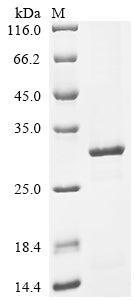 Greater than 85% as determined by SDS-PAGE.Recombinant Human Cytomegalovirus Major Capsid Protein (MCP) Protein (His)