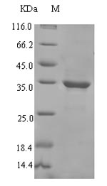 Greater than 90% as determined by SDS-PAGE.