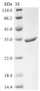 Greater than 90% as determined by SDS-PAGE.Recombinant Saccharomyces Cerevisiae Heat Shock Protein 60, Mitochondrial (HSP60) Protein (His)