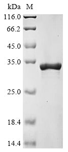 Greater than 90% as determined by SDS-PAGE.Recombinant Mouse Interferon-Activable Protein 204 (IFI204) Protein (His&Myc)