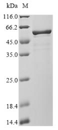 Greater than 90% as determined by SDS-PAGE.Recombinant Human Coronavirus 229E Nucleoprotein (N) Protein (His)