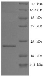 Greater than 90% as determined by SDS-PAGE.Recombinant Bovine Interferon Tau-1 (IFNT1) Protein (His)