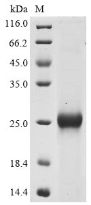 Greater than 85% as determined by SDS-PAGE.Recombinant Bovine Coronavirus Spike Glycoprotein (S) Protein (His)