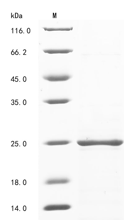 Greater than 90% as determined by SDS-PAGE.Recombinant Mouse Tumor Rejection Antigen P815A (TRAP1A) Protein (His&Myc)