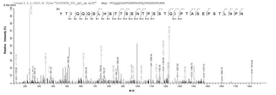 Based on the SEQUEST from database of E.coli host and target protein, the LC-MS/MS Analysis result of this product could indicate that this peptide derived from E.coli-expressed Human respiratory syncytial virus B (strain 18537) G.Recombinant Human Respiratory Syncytial Virus B Major Surface Glycoprotein G (G) Protein (His)