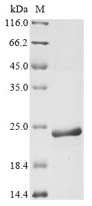Greater than 90% as determined by SDS-PAGE.Recombinant Feline Immunodeficiency Virus Gag Polyprotein (GAG) Protein (His&Myc)