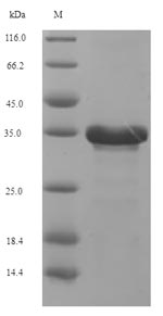 Greater than 90% as determined by SDS-PAGE.