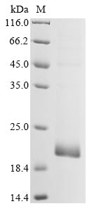 Greater than 85% as determined by SDS-PAGE.Recombinant Human Coronavirus 229E Membrane Protein (M) Protein (His)