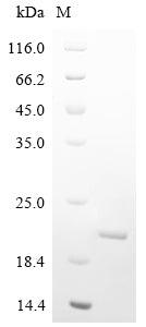 Greater than 90% as determined by SDS-PAGE.Recombinant Human Parainfluenza 1 Virus Hemagglutinin-Neuraminidase (HN) Protein (His)