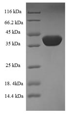 Greater than 90% as determined by SDS-PAGE.