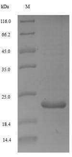 Greater than 90% as determined by SDS-PAGE.Recombinant Woodchuck Hepatitis B Virus Protein X (X) Protein (His)