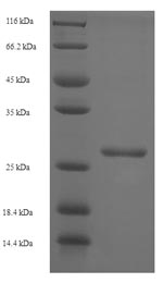 Greater than 90% as determined by SDS-PAGE.Recombinant Simian Immunodeficiency Virus Protein Vpx (VPX) Protein (His-SUMO)