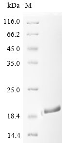 Greater than 90% as determined by SDS-PAGE.Recombinant E.Coli Ribonuclease E (RNE) Protein (His)