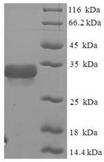 Greater than 90% as determined by SDS-PAGE.Recombinant Glycine Max 2S Albumin Protein (His-SUMO)