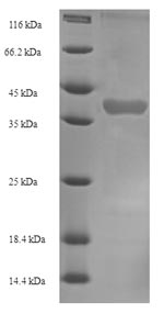 Greater than 90% as determined by SDS-PAGE.Recombinant Mouse Kallikrein 1-Related Peptidase B22 (KLK1B22) Protein (His-SUMO)