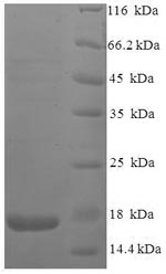 Greater than 90% as determined by SDS-PAGE.Recombinant Human Immunodeficiency Virus Type 2 Subtype A Protein Vpx (VPX) Protein (His)