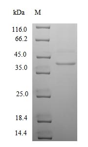 Greater than 90% as determined by SDS-PAGE.Recombinant Human Cytomegalovirus Uncharacterized Protein Ul130 (UL130) Protein (His-SUMO)