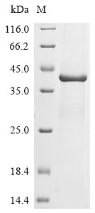 Greater than 85% as determined by SDS-PAGE.Recombinant Murine Polyomavirus Major Capsid Protein Vp1 Protein (His)