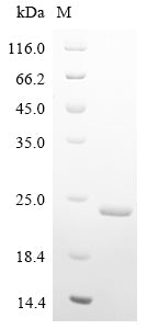 Greater than 90% as determined by SDS-PAGE.Recombinant Human Parainfluenza 2 Virus Hemagglutinin-Neuraminidase (HN) Protein (His)