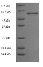 Greater than 90% as determined by SDS-PAGE.Recombinant Clostridium Butyricum Botulinum Neurotoxin Type E (BONT/E) Protein (His-SUMO)