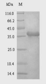 Greater than 90% as determined by SDS-PAGE.