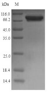 Greater than 90% as determined by SDS-PAGE.Recombinant E.Coli Malate Synthase G (GLCB) Protein (His)