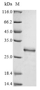 Greater than 85% as determined by SDS-PAGE.Recombinant Schistosoma Mansoni Antigenic Integral Membrane Glycoprotein Protein (His-Trx)