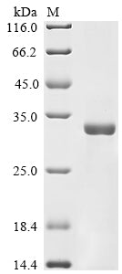 Greater than 85% as determined by SDS-PAGE.Recombinant Penicillium Citrinum Nuclease P1 Protein (His)