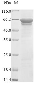 Greater than 90% as determined by SDS-PAGE.Recombinant Crimean-Congo Hemorrhagic Fever Virus Nucleoprotein (N) Protein (His-B2M)
