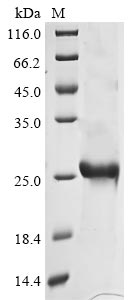 Greater than 85% as determined by SDS-PAGE.Recombinant Avian Infectious Bronchitis Virus Spike Glycoprotein (S) Protein (His)