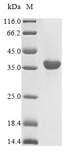 Greater than 85% as determined by SDS-PAGE.Recombinant Human Hla Class I Histocompatibility Antigen, A Alpha Chain (HLA-A) Protein (His)