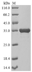 Greater than 85% as determined by SDS-PAGE.